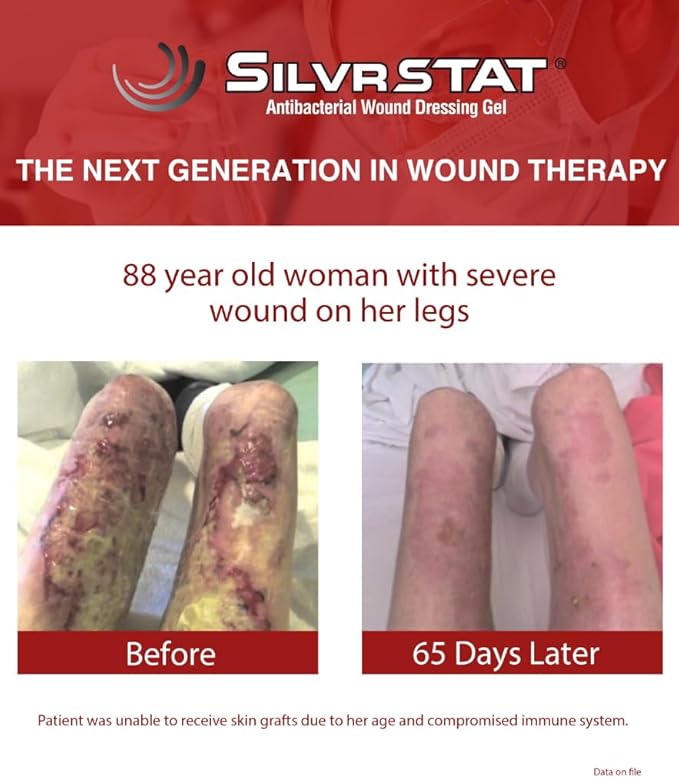 SilvrSTAT First Aid Kit Gel | 32 PPM Silver Healing Wound Dressing Gel | SilverSol Ag₄O₄ Particles | 1 oz